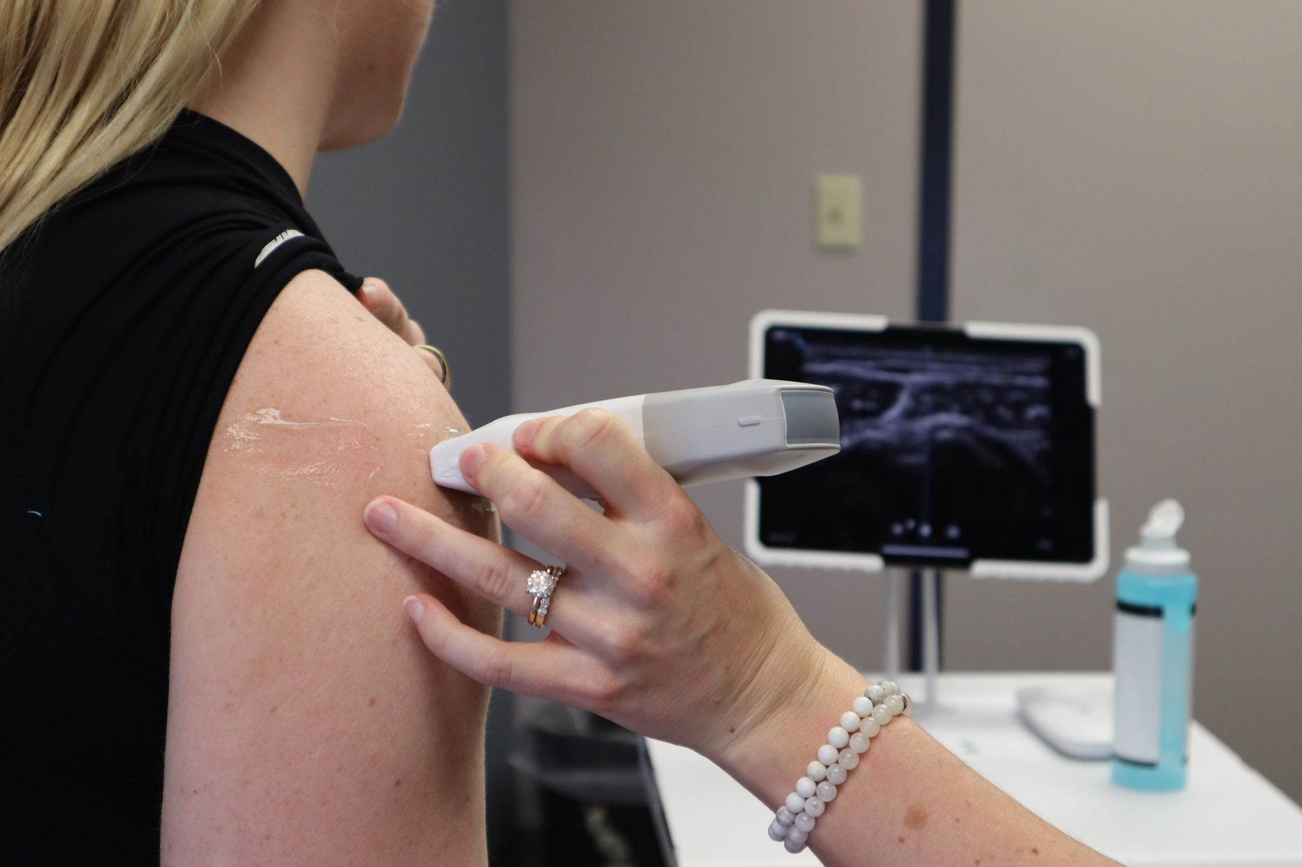 ultrasound standards arthritis diagnosis