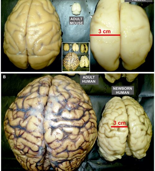 chimpanzee brain development