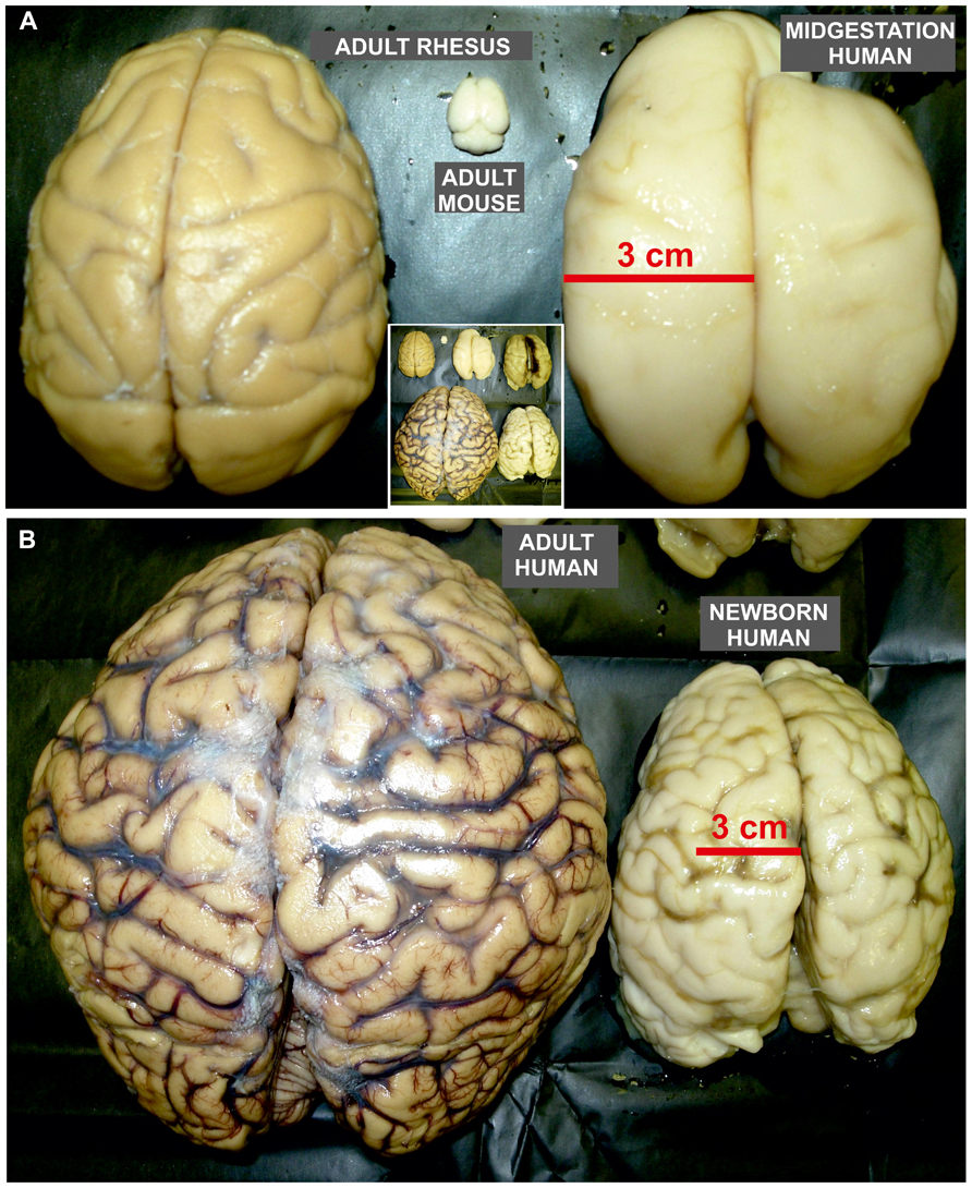 chimpanzee brain development